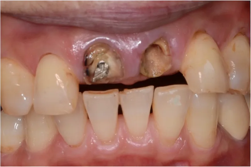case1before