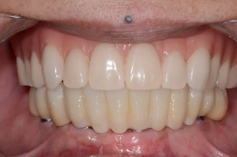 case5after