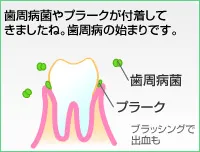 初期