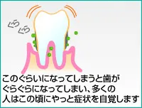 末期